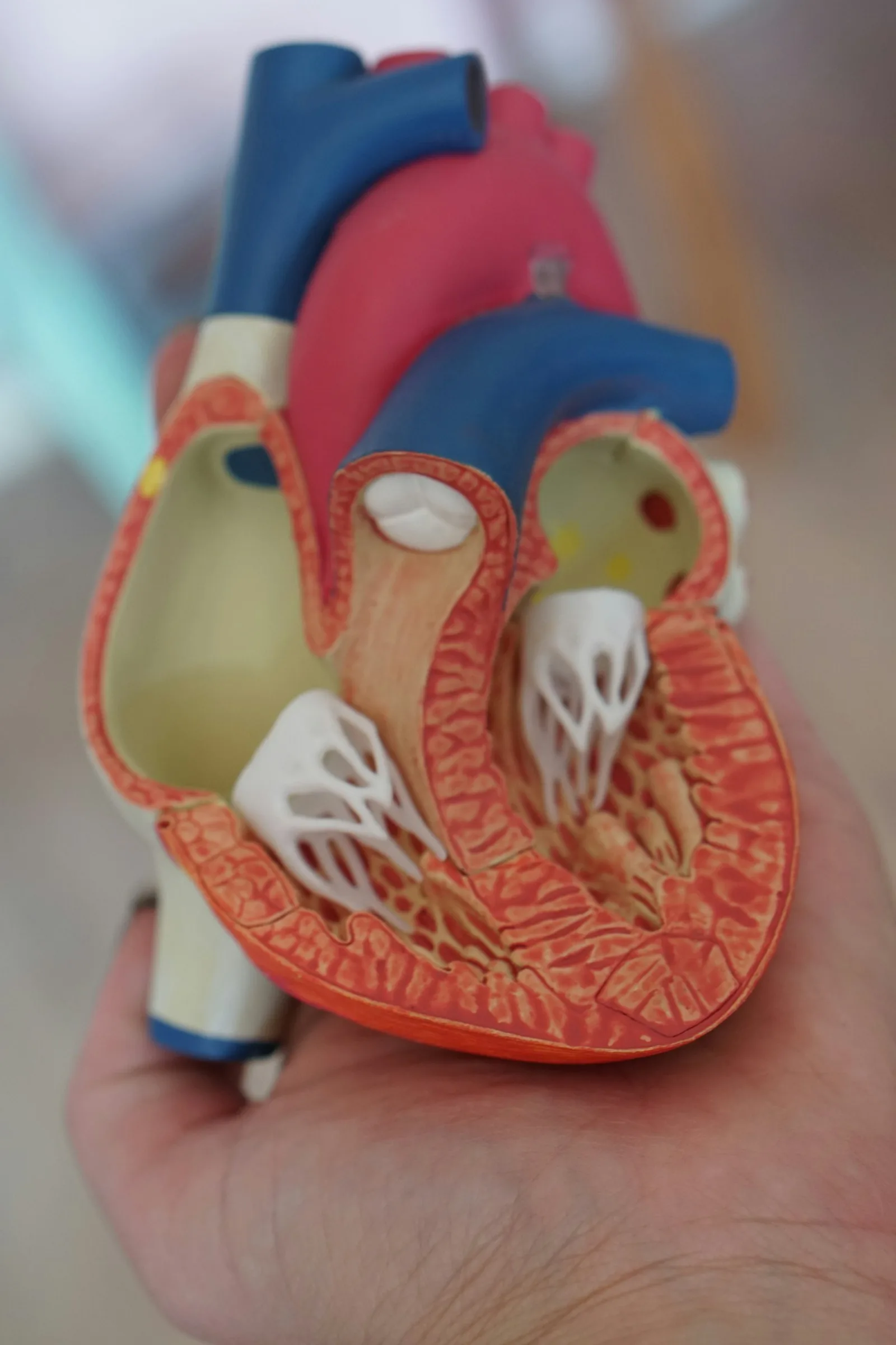 Žmogaus širdies anatominis modelis — lėtinis uždegimas kraujagyslėse yra tikroji infarkto priežastis, ne cholesterolis
